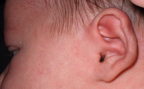Ears